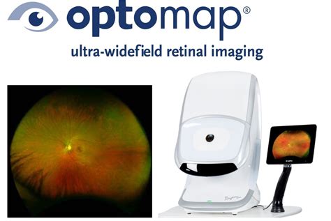 High tech eye exams for a more accurate result | Total Family Eyecare