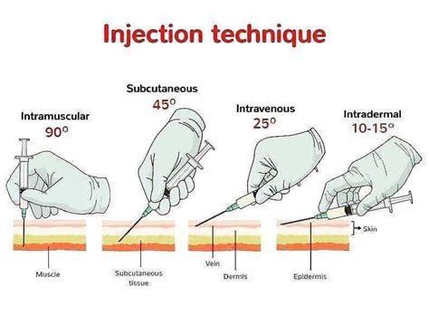 2917 best Injections images on Pholder | Programmer Humor, Transtimelines and Coolguides