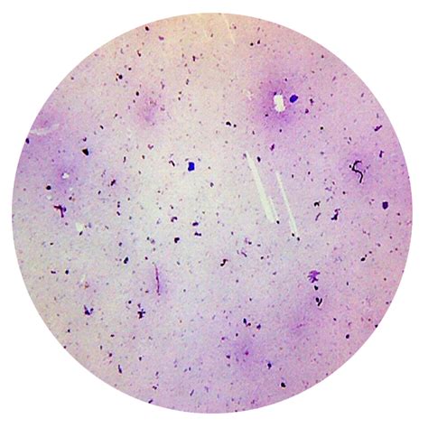 Prepared Slides, Bacteria Smear, Each - American Scientific