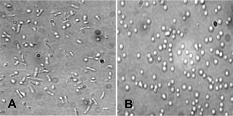 Spheroplast formation by the gas vesicle deficient strain SD109 results...