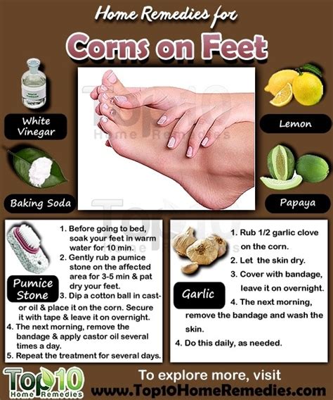 Home Remedies for Corns on Feet - Page 2 of 3 | Top 10 Home Remedies