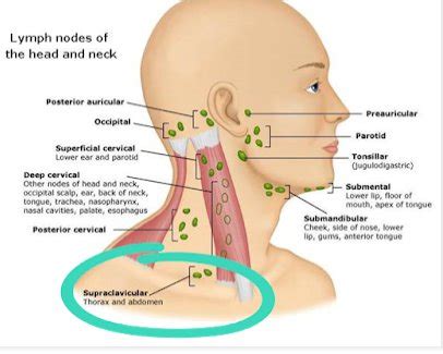 Posteridad Decir a un lado radical auricular lymph nodes único ...