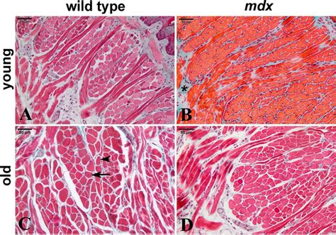 Cross sections of mid-belly tongue muscle. Young wild type (A), young ...