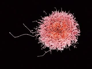 Human Natural Killer Cell | Colorized scanning electron micr… | Flickr