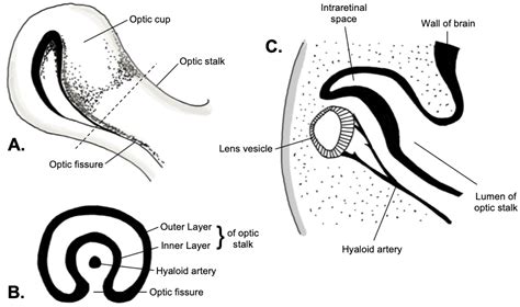 Embryology, Optic Fissure Article