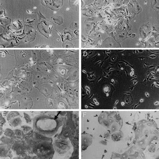 Villous trophoblast cultures obtained from 30-min preparations when... | Download Scientific Diagram