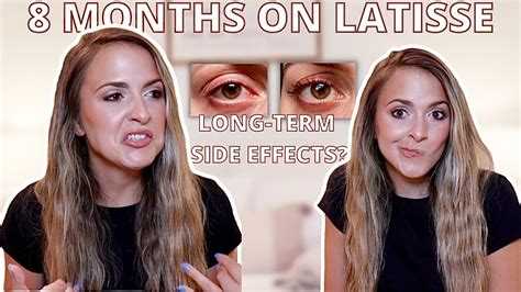 8 MONTH LATISSE RESULTS: how to maintain results & conserve product| any long lasting side ...