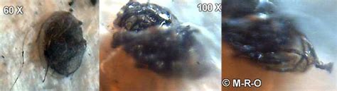 morgellons microscopic pictures photos fibers gmo pics