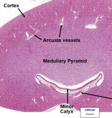 Minor Calyx Histology