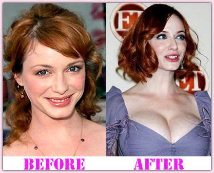 Health, Happiness and Health Promotion | Christina hendricks, Plastic surgery, Christina