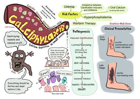 Calciphylaxis or calcific uremic arteriolopathy in CKD - Creative Med Doses