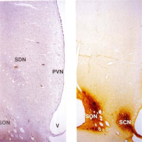 Thionine (left) and anti-vasopressin (right) stained section through ...