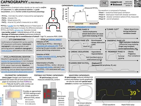 end tidal co2 monitoring waveforms - Glory Lindberg