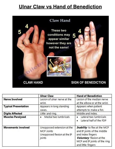 Benediction Sign Median Nerve | My XXX Hot Girl