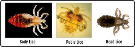 Differences Among Head Lice, Body Lice, and Pubic Lice | LiceDoctors