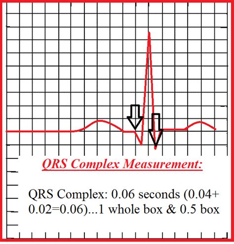 How To Measure A QRS Complex On An EKG Strip QRS Complex Measurement Quiz 47158 | Hot Sex Picture