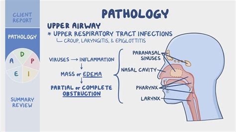 Foreign body aspiration and upper airway obstruction: Nursing process (ADPIE) - Osmosis Video ...