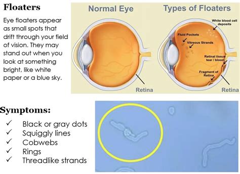 Eye Emergencies (Pink/Red Eyes)