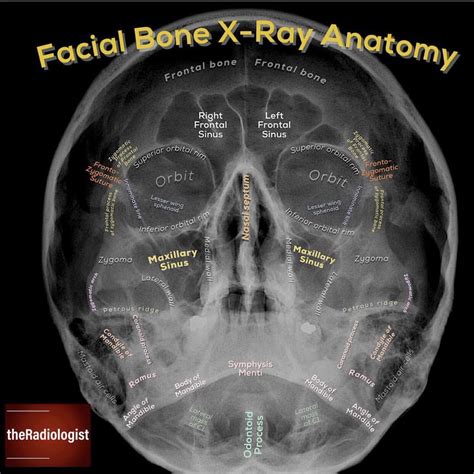 Caldwell Skull X Ray Anatomy