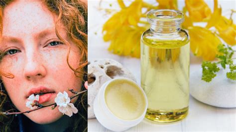 10 Natural Remedies for Dry Lips - Boldsky.com