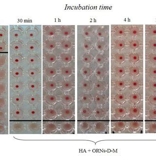 View of the hemagglutination reaction mixtures displayed in a ...