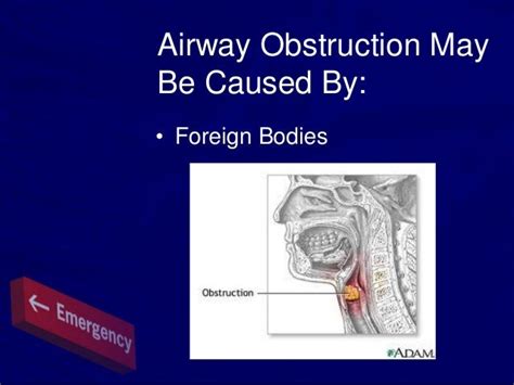 Airway obstruction1