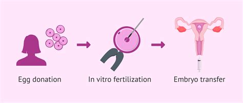 IVF donation process