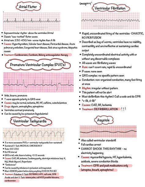 Basic EKG Dysrhythmias & Interpretation Nursing Notes 6 PAGES Digital Download PDF - Etsy Canada ...