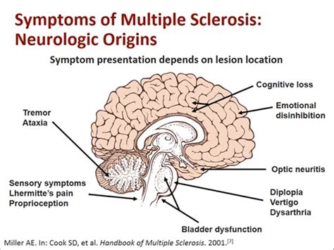 New Challenges Facing Multiple Sclerosis Nurses (Transcript)