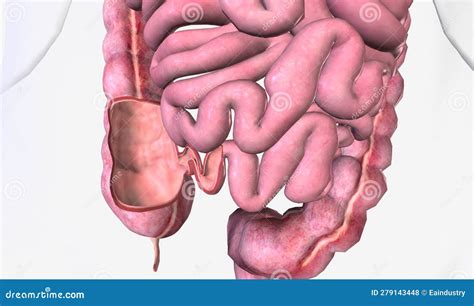 The Ileocecal Valve is To Limit the Backflow of Colonic Contents Stock ...