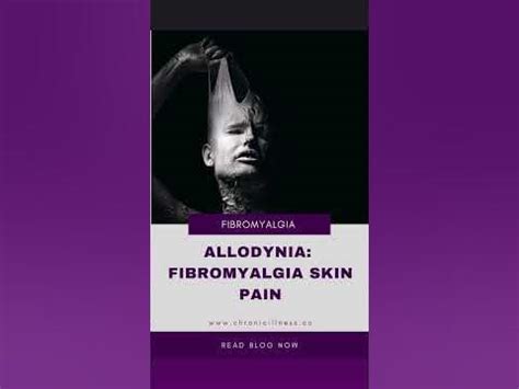 Allodynia & Fibromyalgia | Fibromyalgia Awareness | Fibromyalgia ...