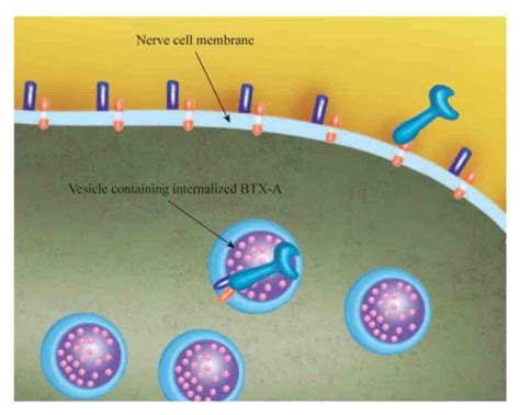 Unit 4: Introduction To Botulinum Toxin & Mechanism Of Action – Vindoc ...