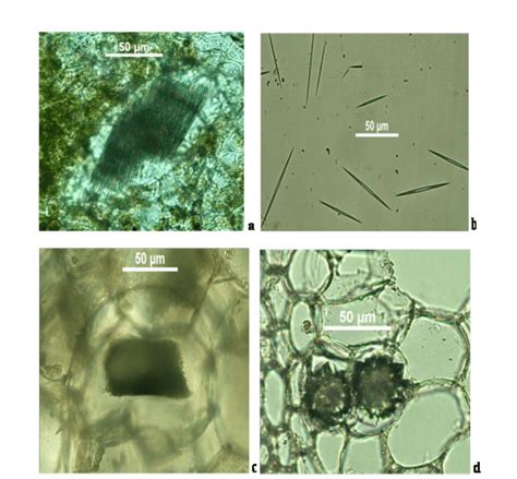 a. Idioblast of E. pinnatum from leaf; b. Calcium oxalate crystal of E.... | Download Scientific ...