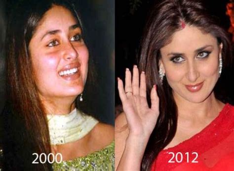 Kareena Kapoor Plastic Surgery Rumors True?