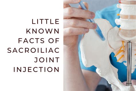 Sacroiliac Joint Injection – South Lake Pain Center – Pain Management ...