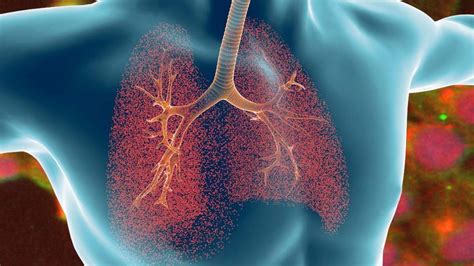 Researchers are studying the treatment of cystic fibrosis with TMEM16A ...