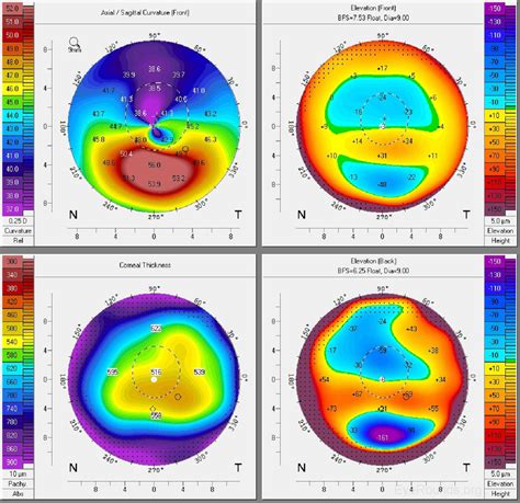 Corneal Imaging: An Introduction