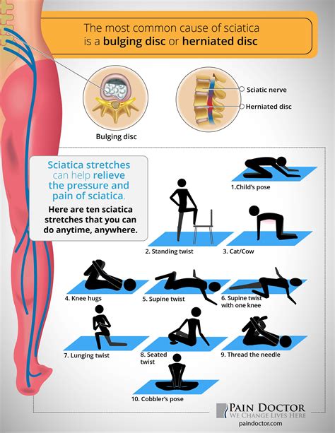 Help For Sciatica | Examples and Forms