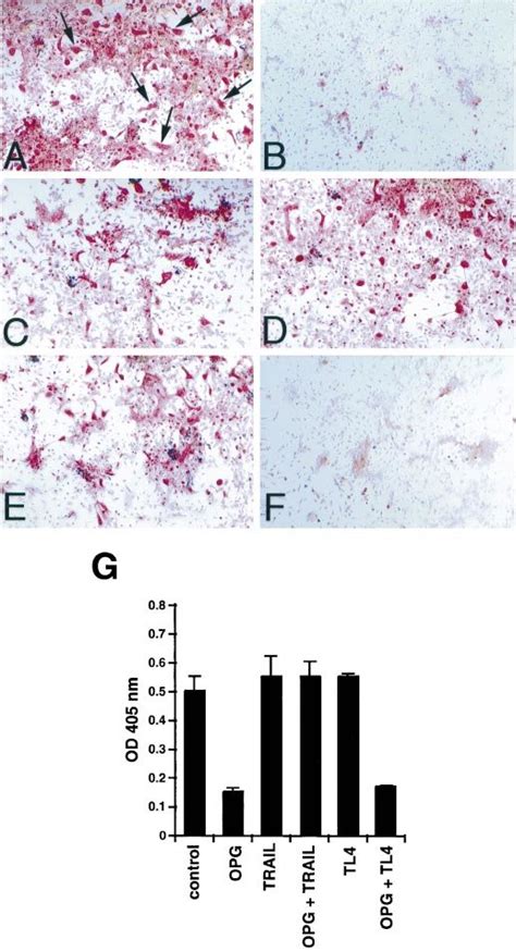 TRAIL blocks the ability of OPG to inhibit osteoclastogenesis. In vitro ...