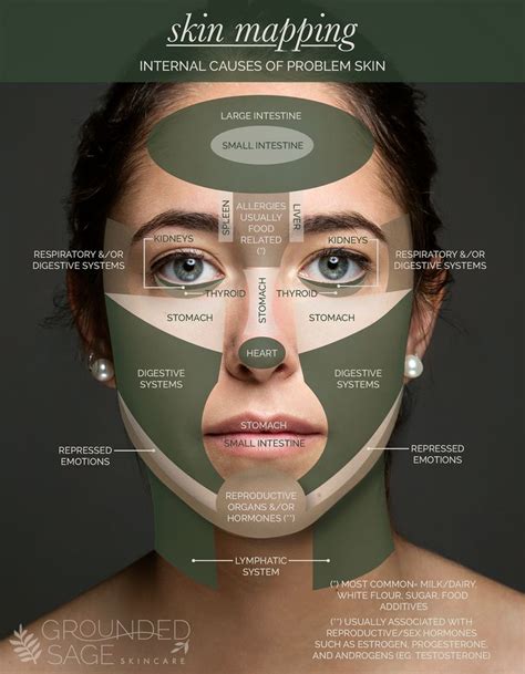 Facemapping Acne | Face mapping acne, Skin mapping, Face acne