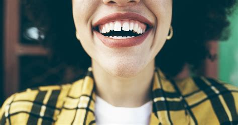 Dental Bonding for Front Tooth Gaps | Aurora | Denver, CO