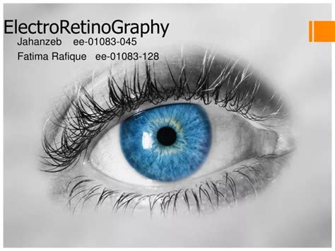 PPT - ElectroRetinoGraphy PowerPoint Presentation - ID:2055117