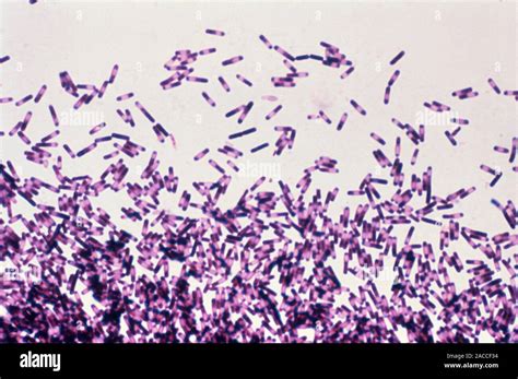 La bacteria Clostridium difficile, micrografía de luz. Estas bacterias ...