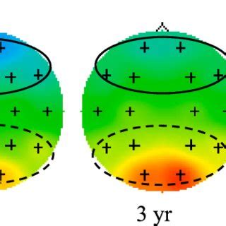 Topographic Maps for 6-9 Hz EEG Power Across Age. Note: The frontal... | Download Scientific Diagram