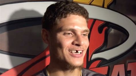 Tyler Johnson Explains Why He Won't Replace Missing Tooth From Last Season