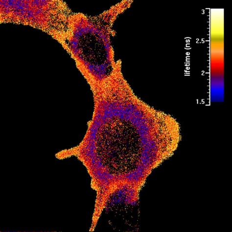 Fluorescence Lifetime Imaging | TOPTICA Photonics AG