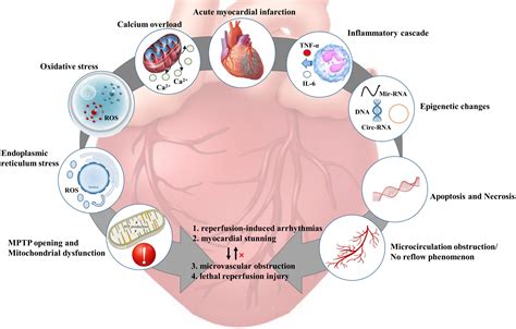 Frontiers | Preclinical multi-target strategies for myocardial ischemia-reperfusion injury