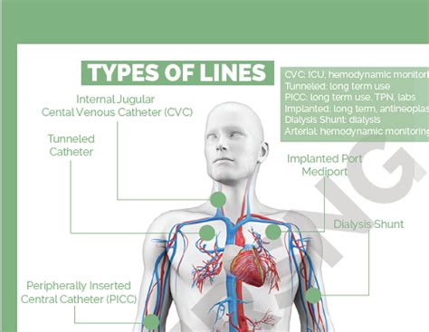 Central Venous Pressure, Central Venous Catheter, Central Line, Types Of Lines, Nursing School ...