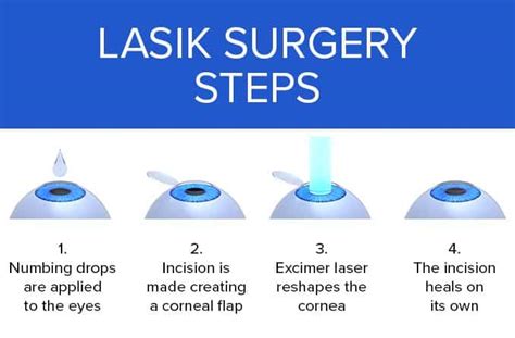 LASIK Laser Eye Surgery - Same Day Quick Visual Recovery - Akıllı Lazer ...