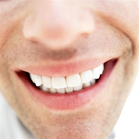 Teeth Whitening